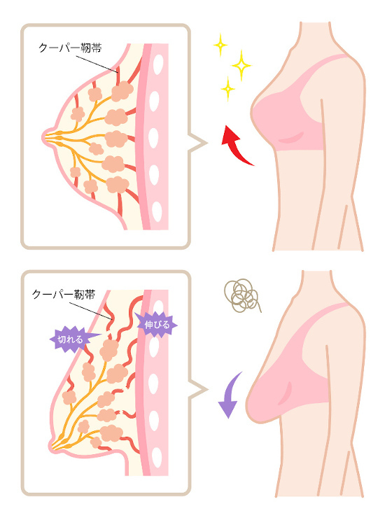 胸の垂れる原因